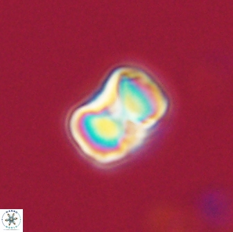 Hypsiteicholithus polymerus 66625