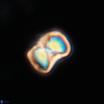 Hypsiteicholithus polymerus 66628