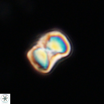 Hypsiteicholithus polymerus 66628