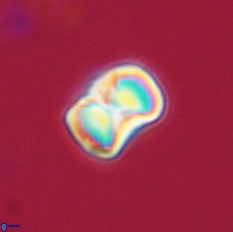 Hypsiteicholithus polymerus 66629