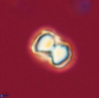 Hypsiteicholithus polymerus 66633