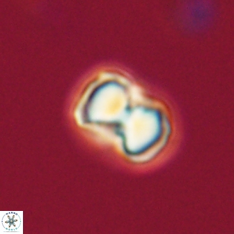 Hypsiteicholithus polymerus 66633