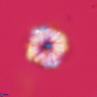 Hypsiteicholithus polymerus 66637