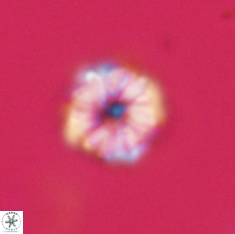 Hypsiteicholithus polymerus 66637