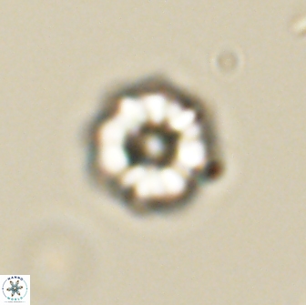 Hypsiteicholithus polymerus 66640