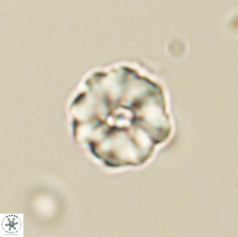 Hypsiteicholithus polymerus 66641