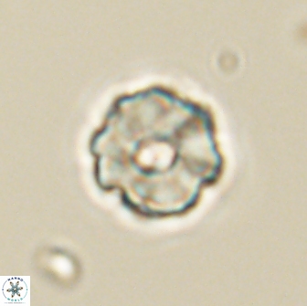 Hypsiteicholithus polymerus 66642