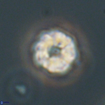 Hypsiteicholithus polymerus 66643