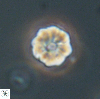 Hypsiteicholithus polymerus 66645