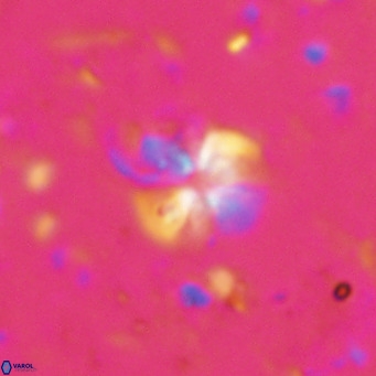 Ilselithina fusa VR 028747