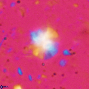 Ilselithina fusa VR 028732
