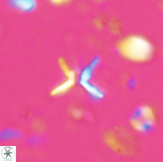 Ilselithina fusa 28044