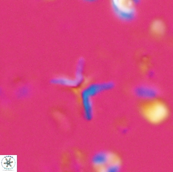 Ilselithina fusa 28047