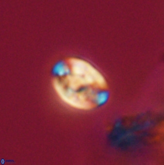 Isocrystallithus compactus 39468