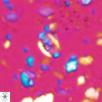 Isocrystallithus partitum 7616