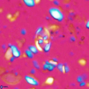 Isocrystallithus partitum 7619