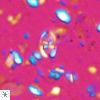 Isocrystallithus partitum 7619