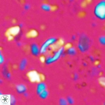 Isocrystallithus partitum 7620