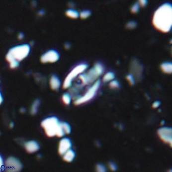 Isocrystallithus partitum 7621