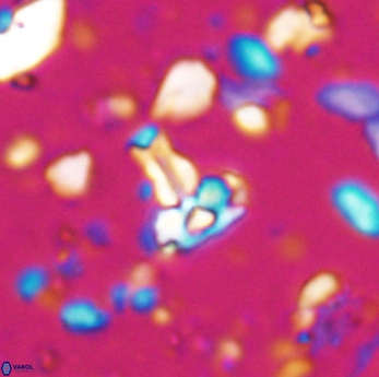 Isocrystallithus partitum 7625