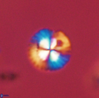 Isespetrinesaspides foteinokentro 55051