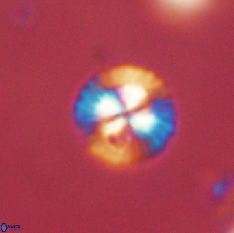 Isespetrinesaspides foteinokentro 55052