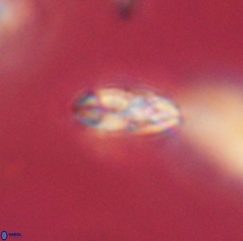 Isespetrinesaspides foteinokentro 55055