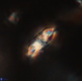 Isespetrinesaspides foteinokentro 55057