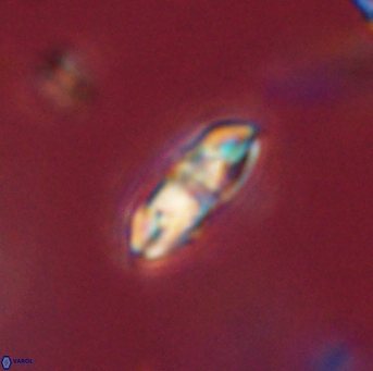 Isespetrinesaspides foteinokentro 55058