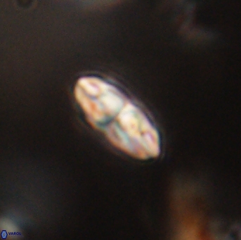 Isespetrinesaspides foteinokentro 55060