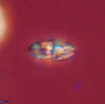 Isespetrinesaspides foteinokentro 55063