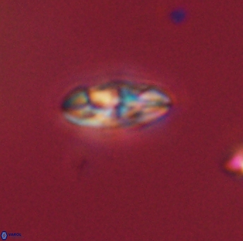 Isespetrinesaspides foteinokentro 55068