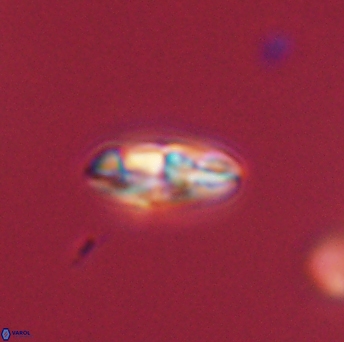 Isespetrinesaspides foteinokentro 55073