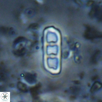 Isthmolithus recurvus 14968
