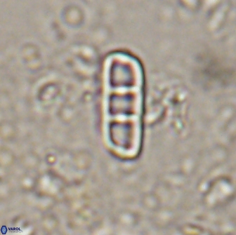 Isthmolithus recurvus 14969