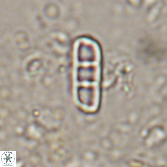 Isthmolithus recurvus 14969