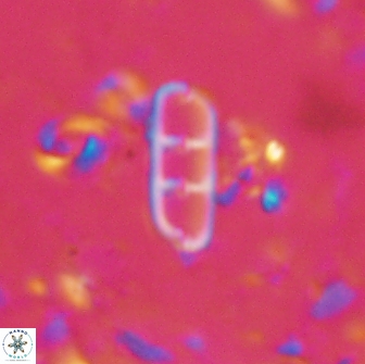 Isthmolithus recurvus 14971