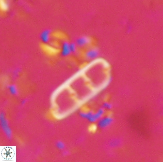 Isthmolithus recurvus 14973