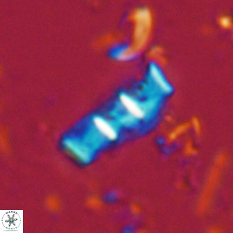 Isthmolithus recurvus 14981