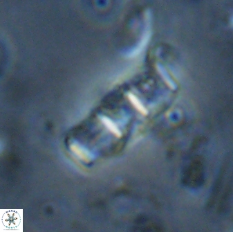 Isthmolithus recurvus 14984