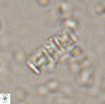 Isthmolithus recurvus 14985