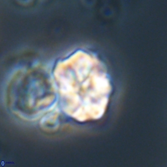 Karoulilithos ayseguliae 21852