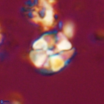 Karoulilithos ayseguliae 21866