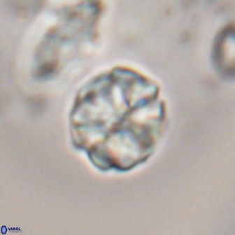 Karoulilithos ayseguliae 21879