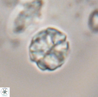 Karoulilithos ayseguliae 21879