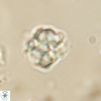 Karoulilithos pseudobiskayae 67674