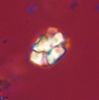 Karoulilithos pseudobiskayae 67710