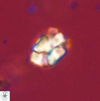 Karoulilithos pseudobiskayae 67710