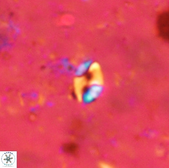 Lanternithus duocavus VR 00067