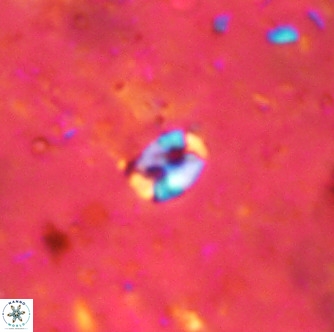 Lanternithus duocavus VR 00068
